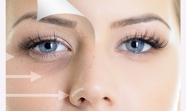 ترکیبات مؤثر در بهترین کرم دور چشم برای تیرگی و پف