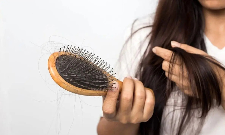 دلایل شایع ریزش مو