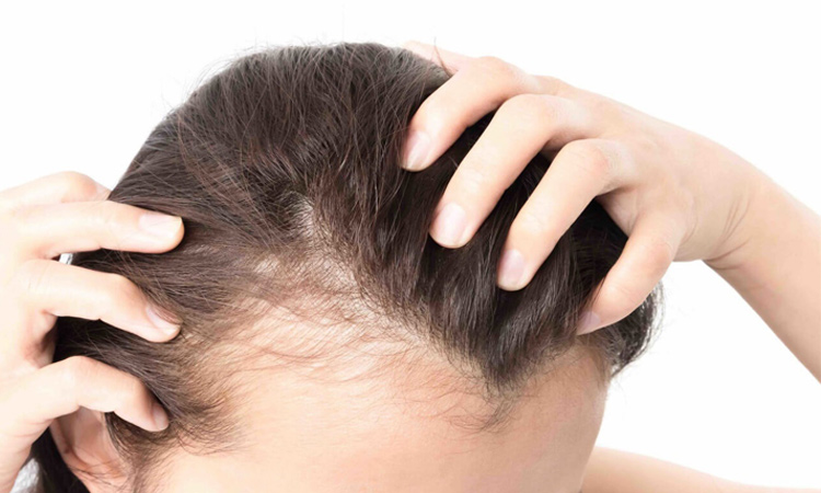 7 نکته برای داشتن موهایی پرپشت‌تر